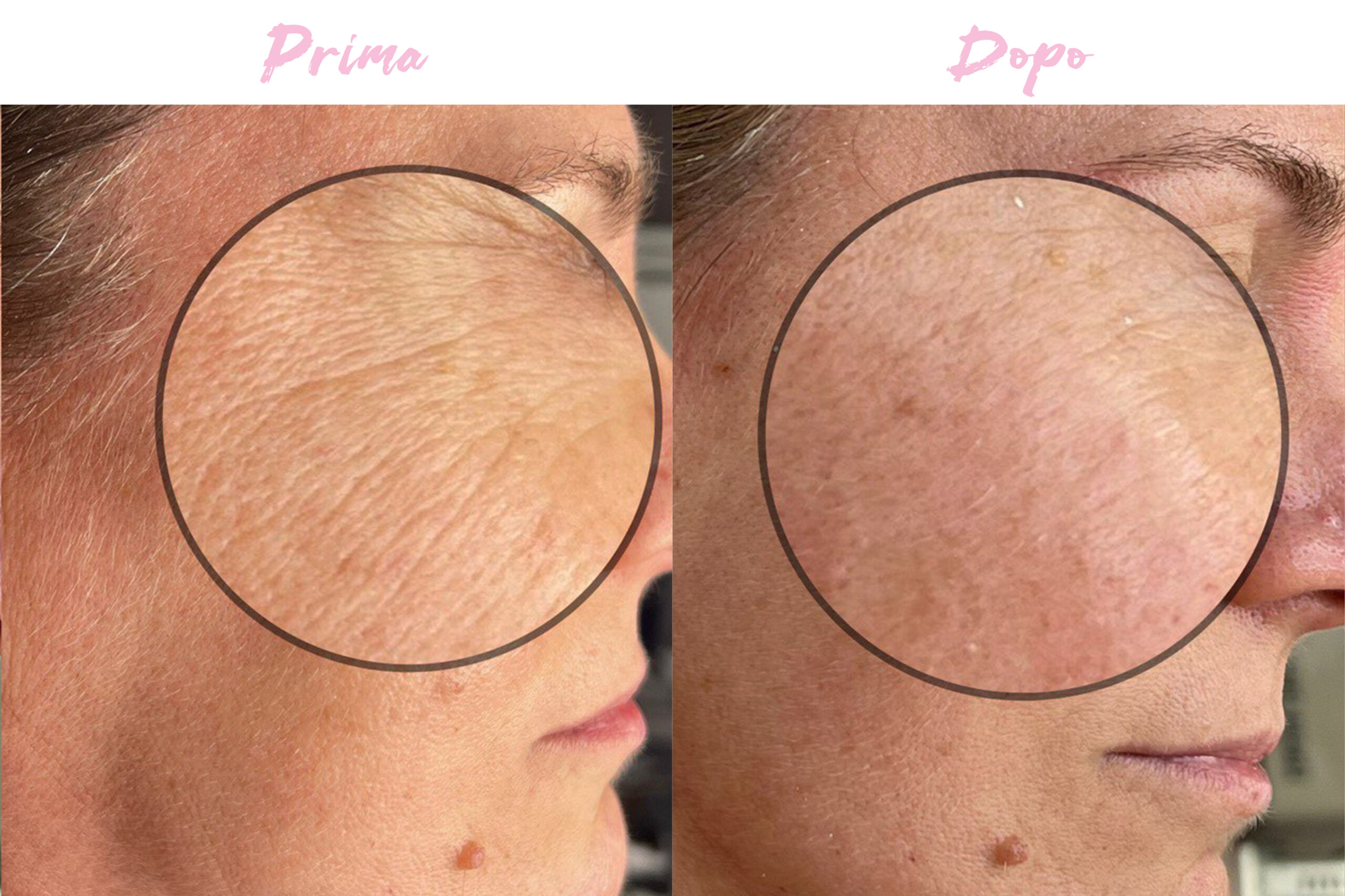 Viso 1 Prima-Dopo