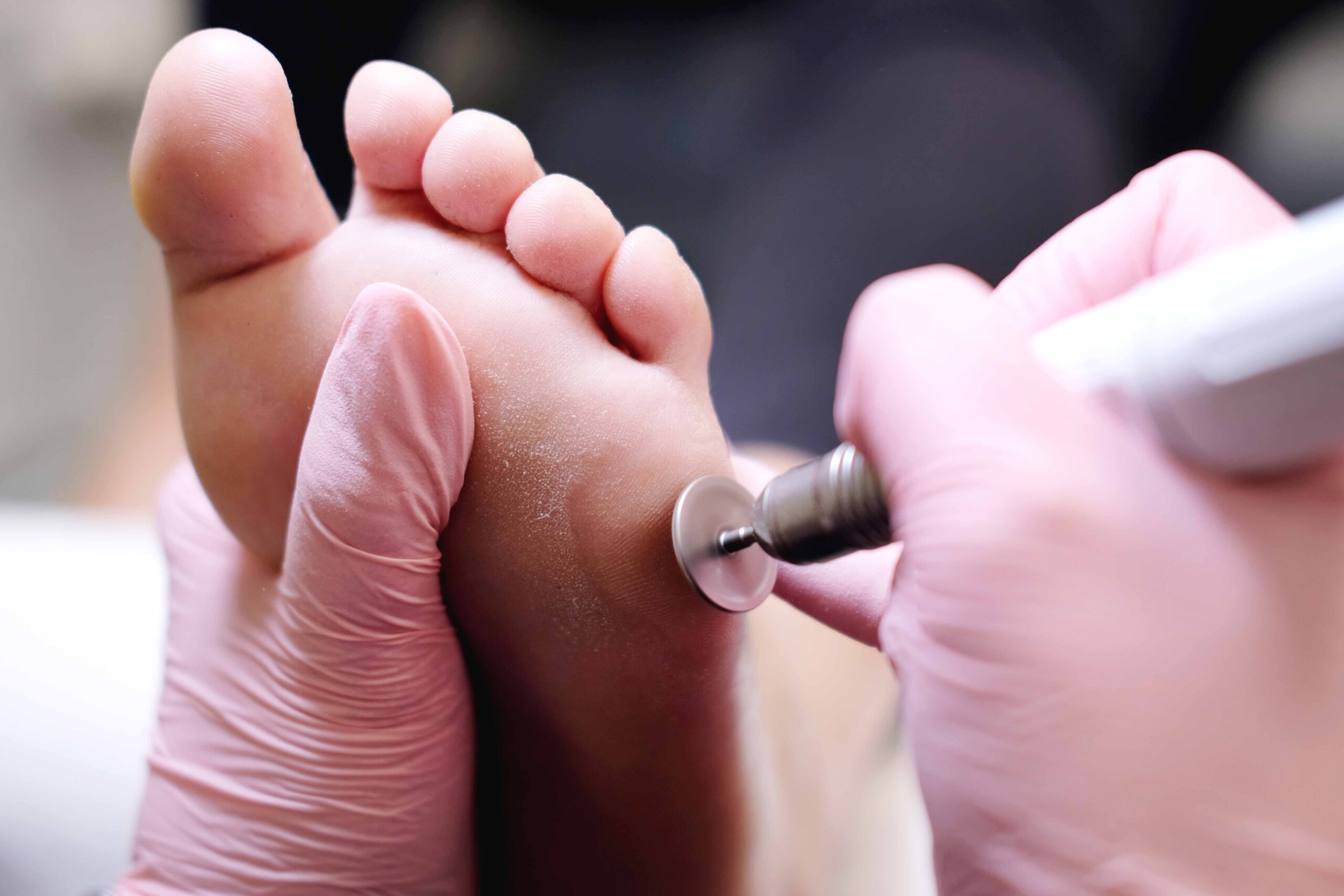 dry-pedicure-emozioni-centro-estetico-3